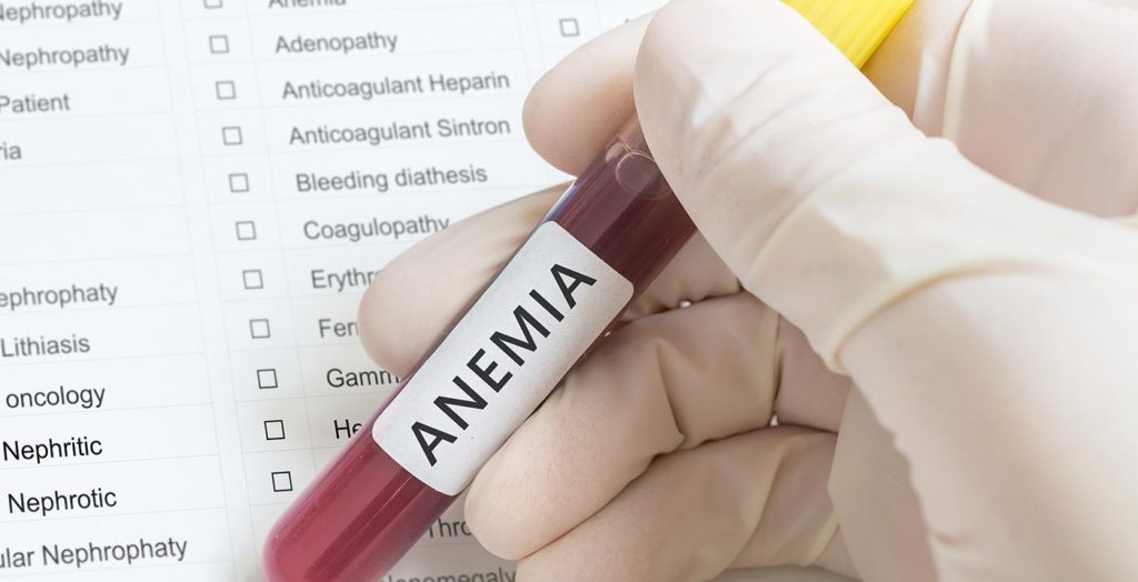 Anemia analisi Bergamo